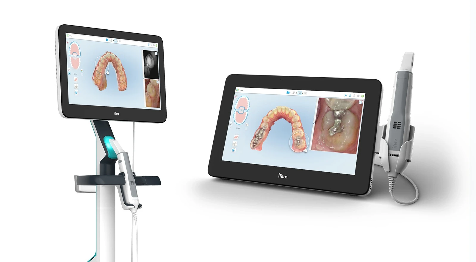 iTero 5D Plus digital scanner for Invisalign treatment