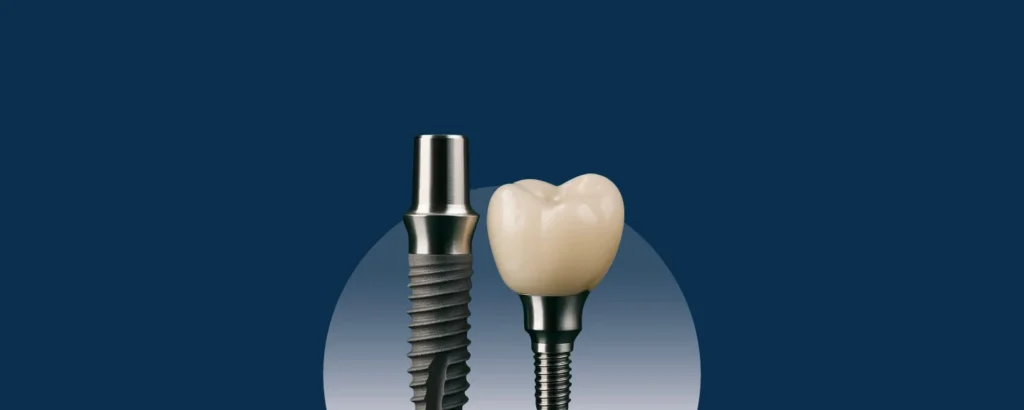 Frontier Dental implant clinic near Bayan Lepas, Penang